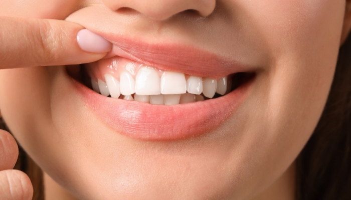 GOOD ORAL HEALTH