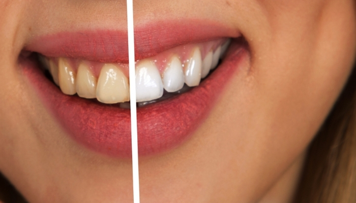 Oral Health